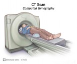 REVIEWING A CT SCAN