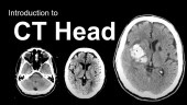 BASIC APPROACH TO HEAD  CT INTERPRETATION