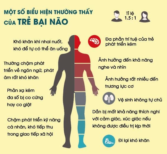 bại não 1